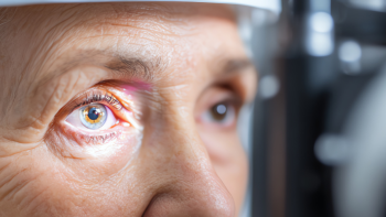 Examen diagnostic cataracte